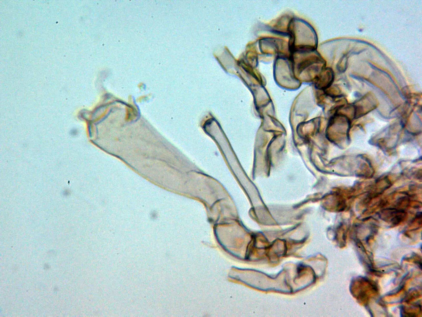Microscopía de Tomentella stuposa - 10 - Basidio 2